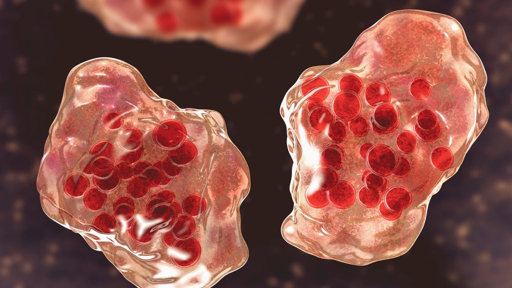 Central Minnesota county reports "several cases of suspected measles" — WCCO / CBS Minnesota, Hastings Health news