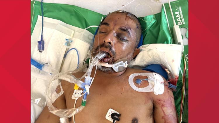University Hospital asks for help identifying unconscious patient hit by truck Saturday evening — KENS 5 (San Antonio), Hastings Health news