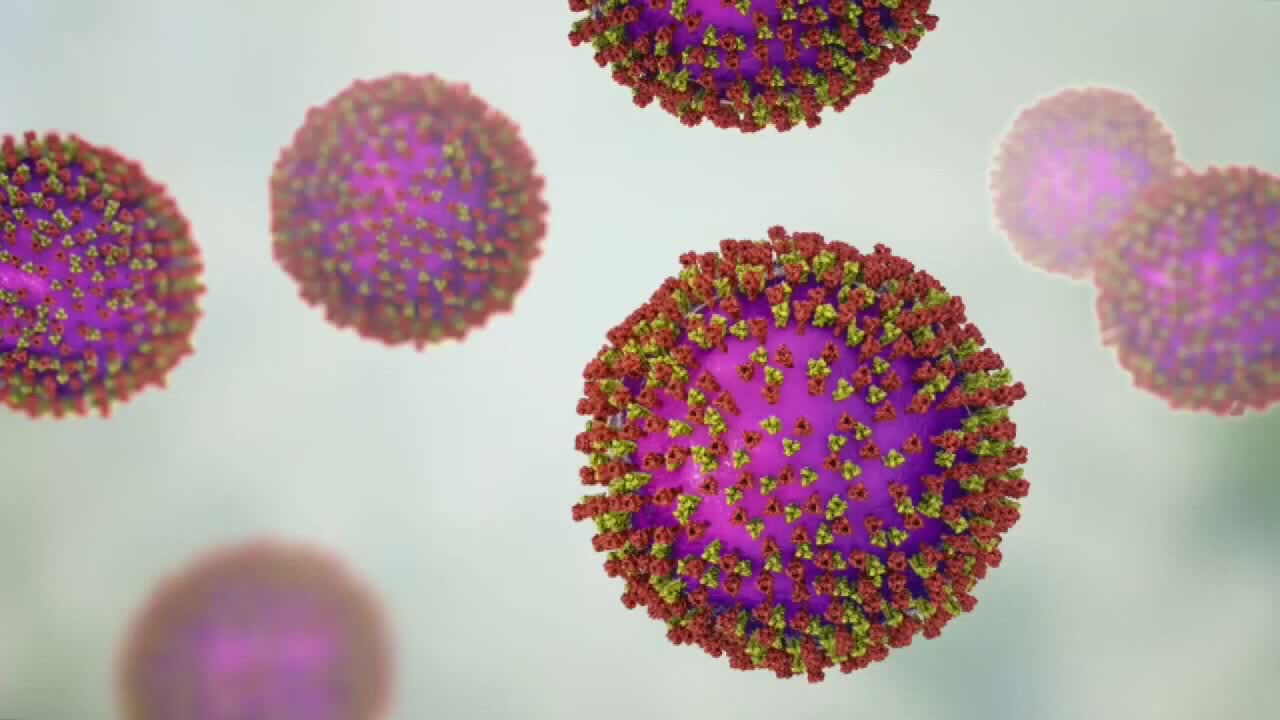 Wisconsin measles outbreak rises to 267 cases as spread continues — FOX 9, Hastings Health news